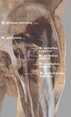quadratus femoris cadaver